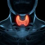 Layout Basic 18 Thyroid cancer