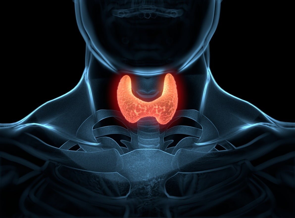 Thyroid cancer