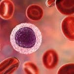 Blood cancer