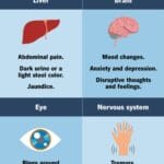 Wilson’s disease