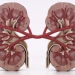 renal cell carcinoma