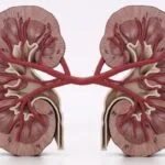 Layout Basic 17 renal cell carcinoma