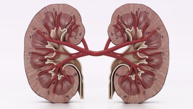 renal cell carcinoma